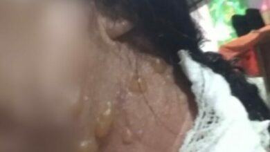 Polícia Civil prende homem que jogou café quente na companheira e causou queimaduras de segundo grau, em Jataí