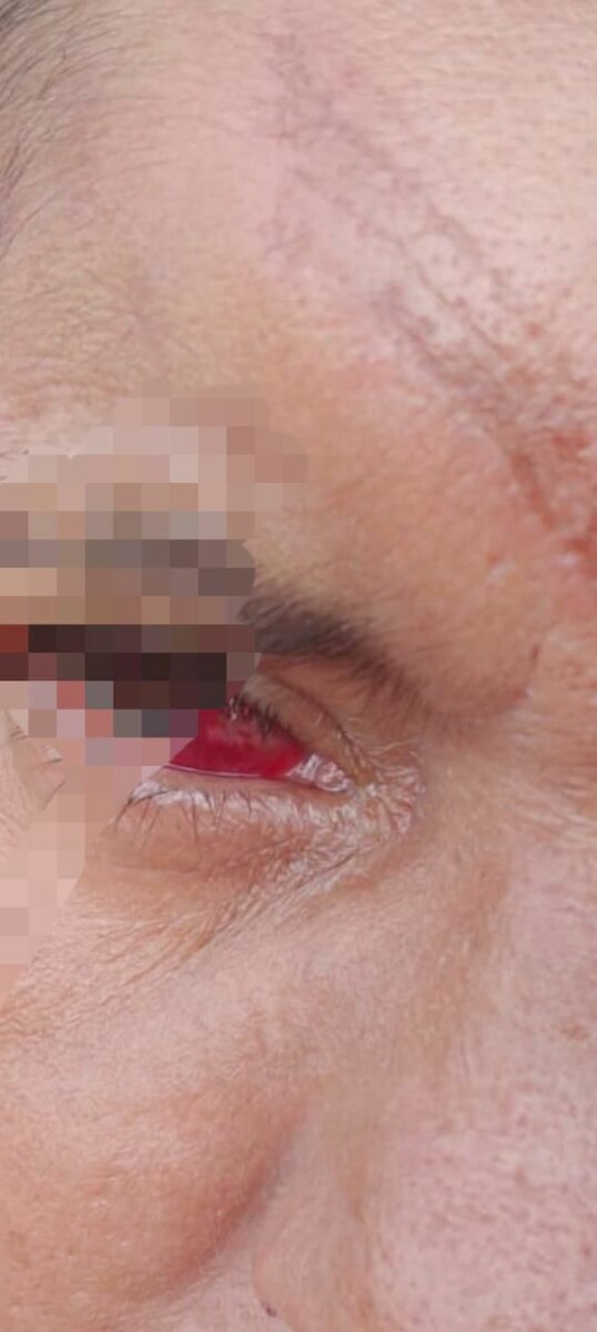 Deam de Santa Helena prende homem por ameaçar, lesionar e estup