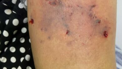 Três pessoas são presas em Itaberaí após Pitbull lesionar vítima