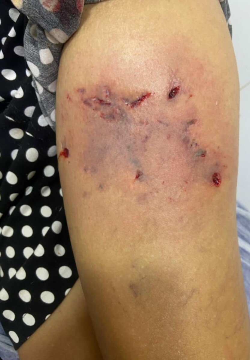 Três pessoas são presas em Itaberaí após Pitbull lesionar vítima